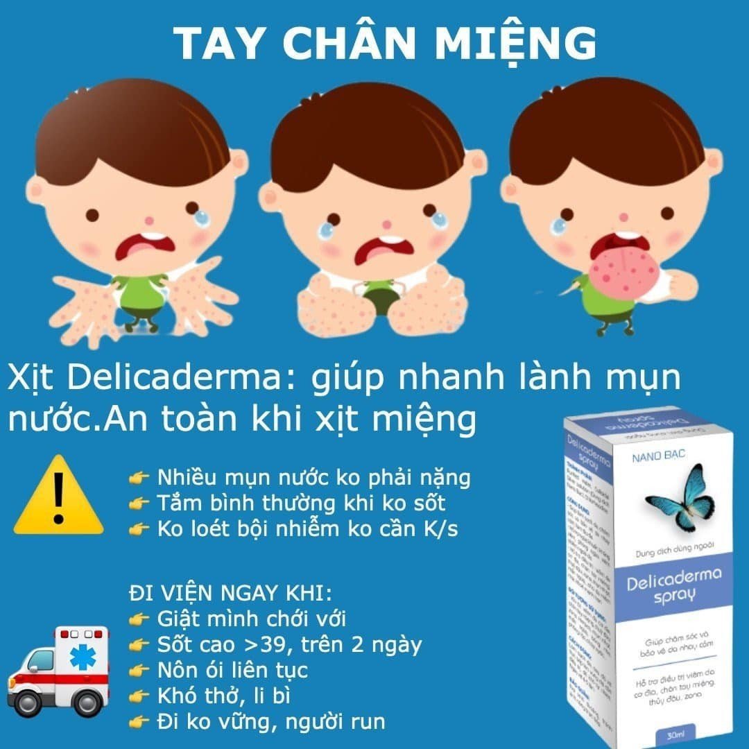 Chân tay miệng