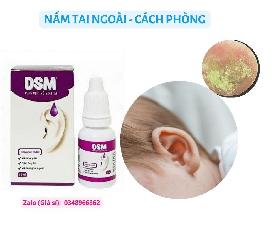 Nấm tai ngoài và cách phòng cho bé