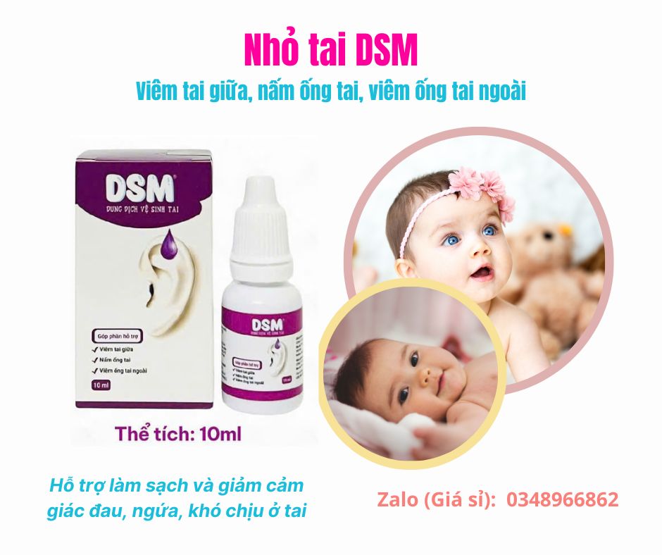 Nhỏ tai DSM khi viêm tai giữa nấm ống tai hoặc viêm tai ngoài